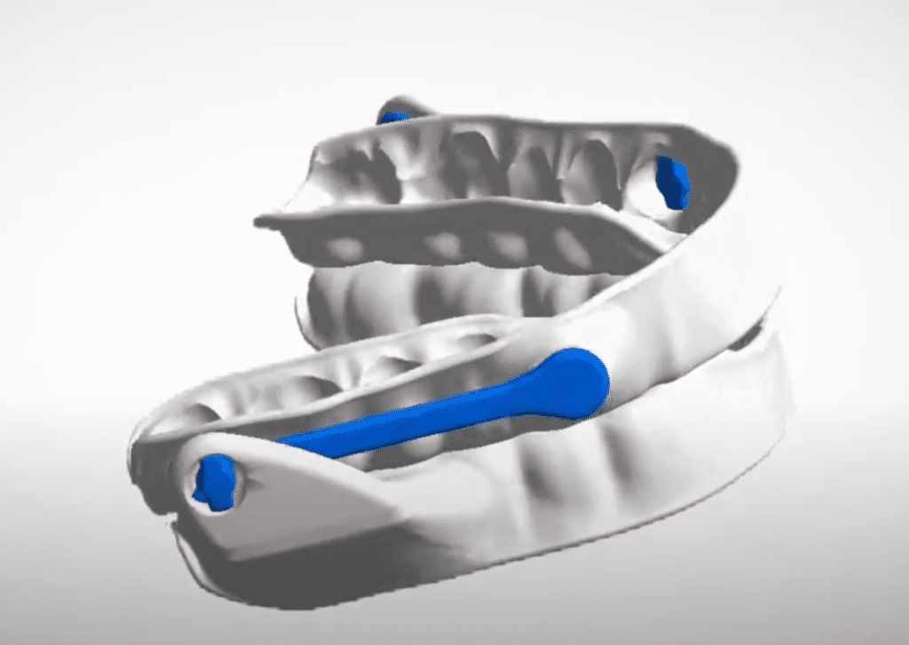 ResMed Narval CC for sleep apnea