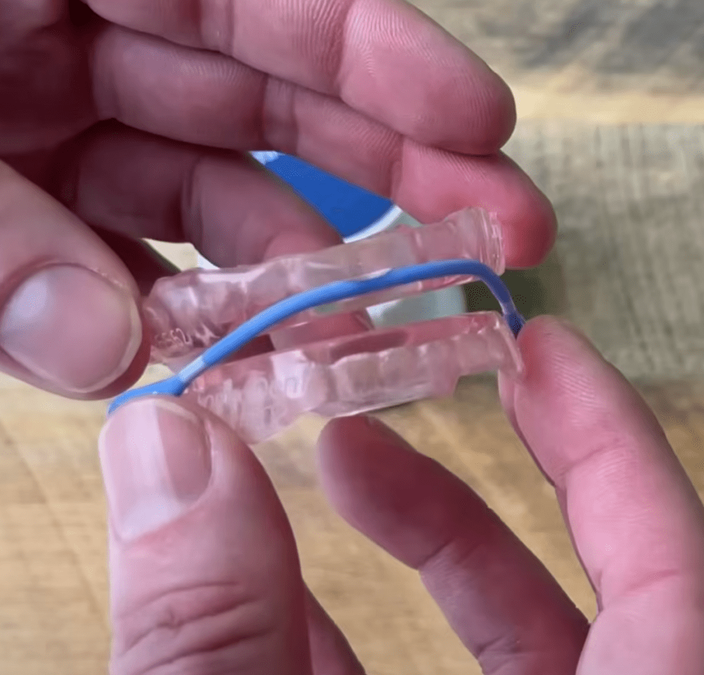 SomnoDent Devices for sleep apnea