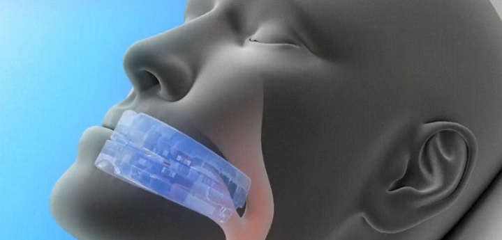 SleepZee Airflow Vents