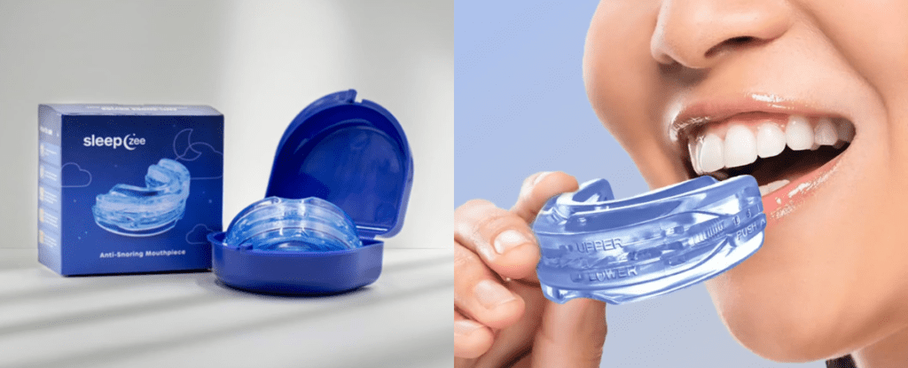 Sleepzee anti-snoring mouthpiece